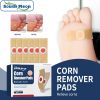 Breathable Foot Callus Isolation Cushion Pads, Anti-Friction Shoe Sore Spot Buffer Protective Plaster